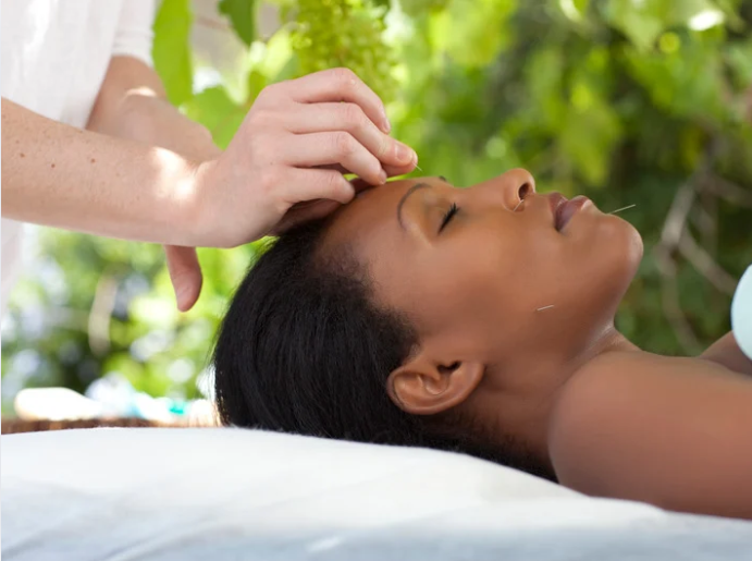 Best Acupuncture Clinic NYC treatment session with relaxing patient receiving holistic pain relief therapy in New York City clinic